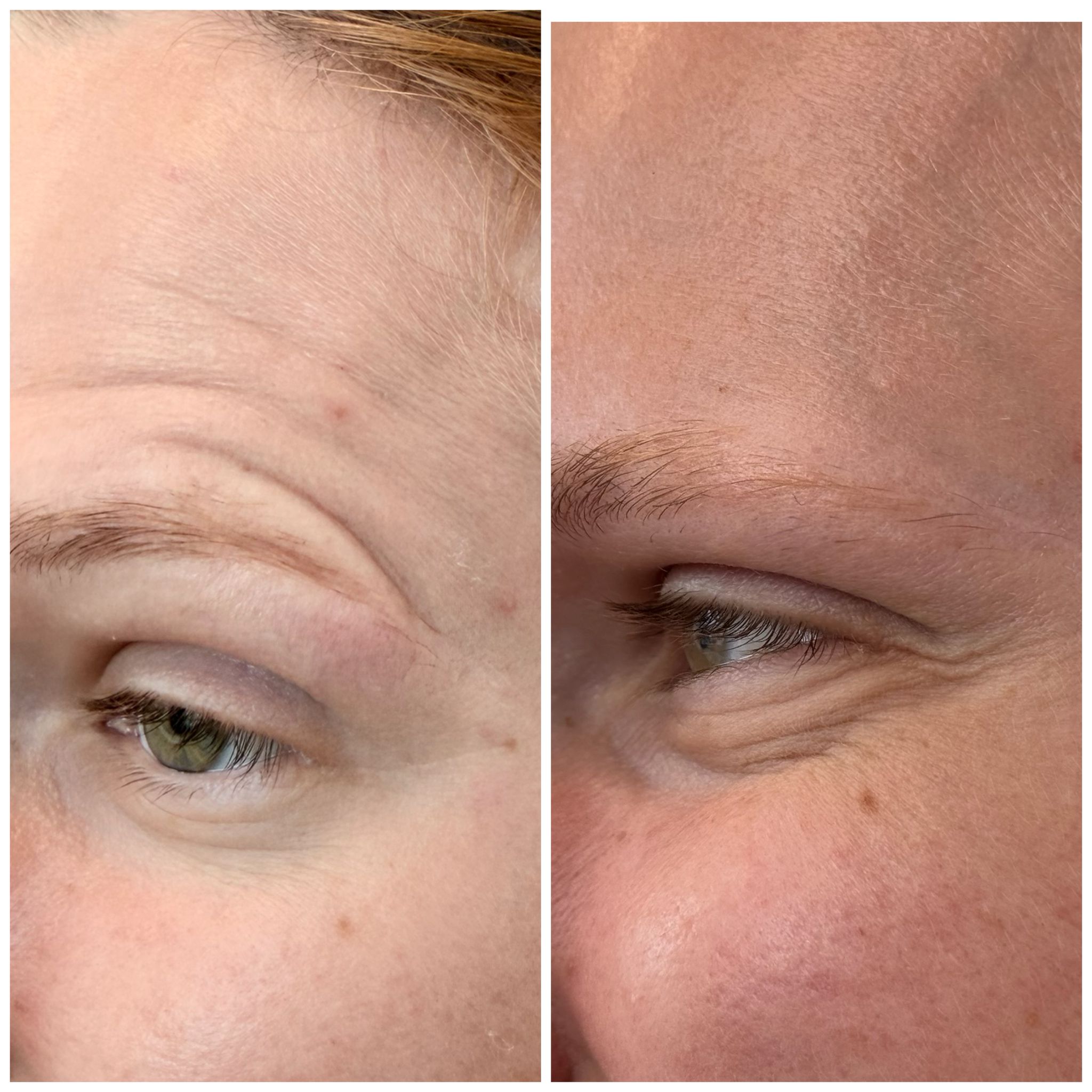 Mintus treatment before and after result 2