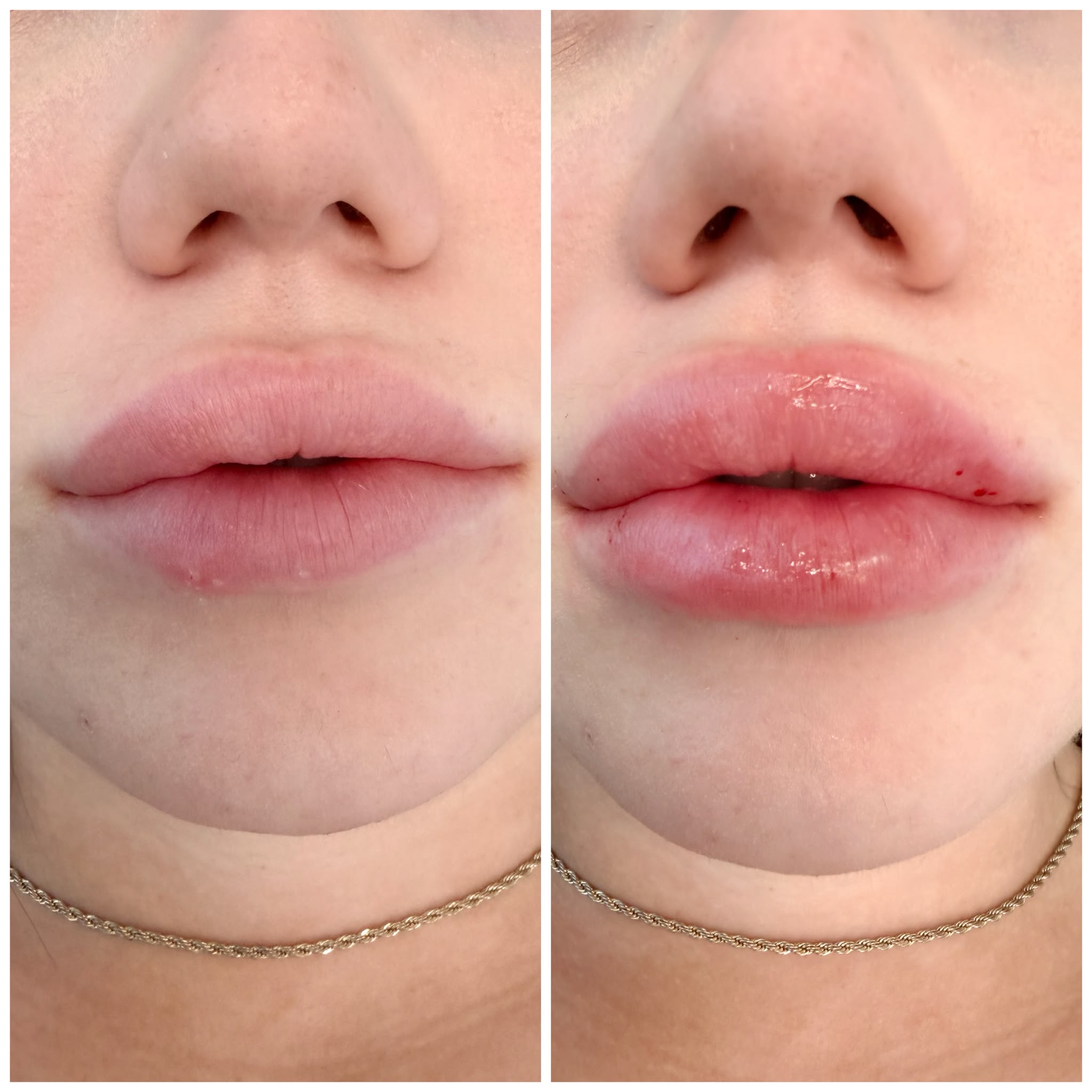 Mintus treatment before and after result 4