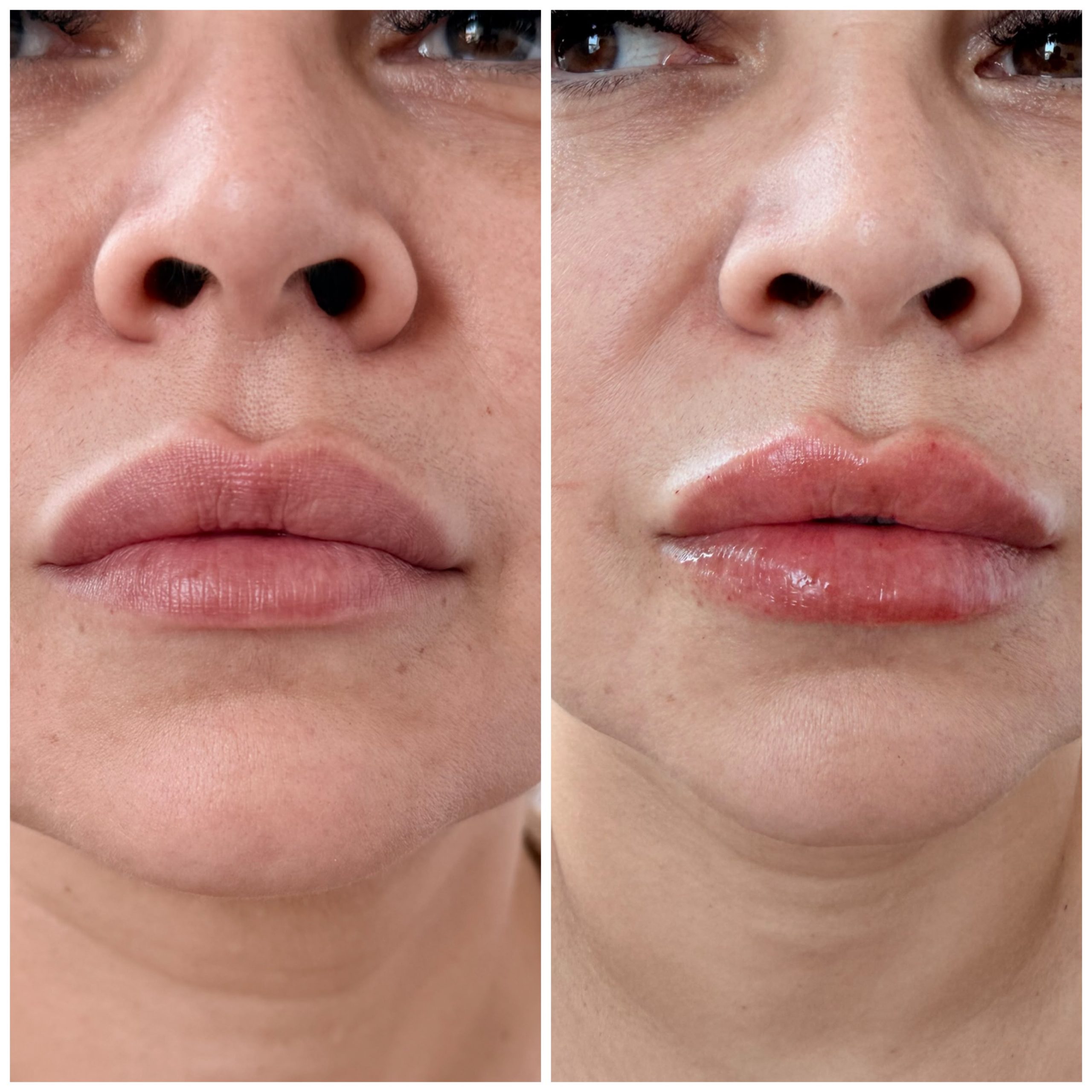 Mintus treatment before and after result 6