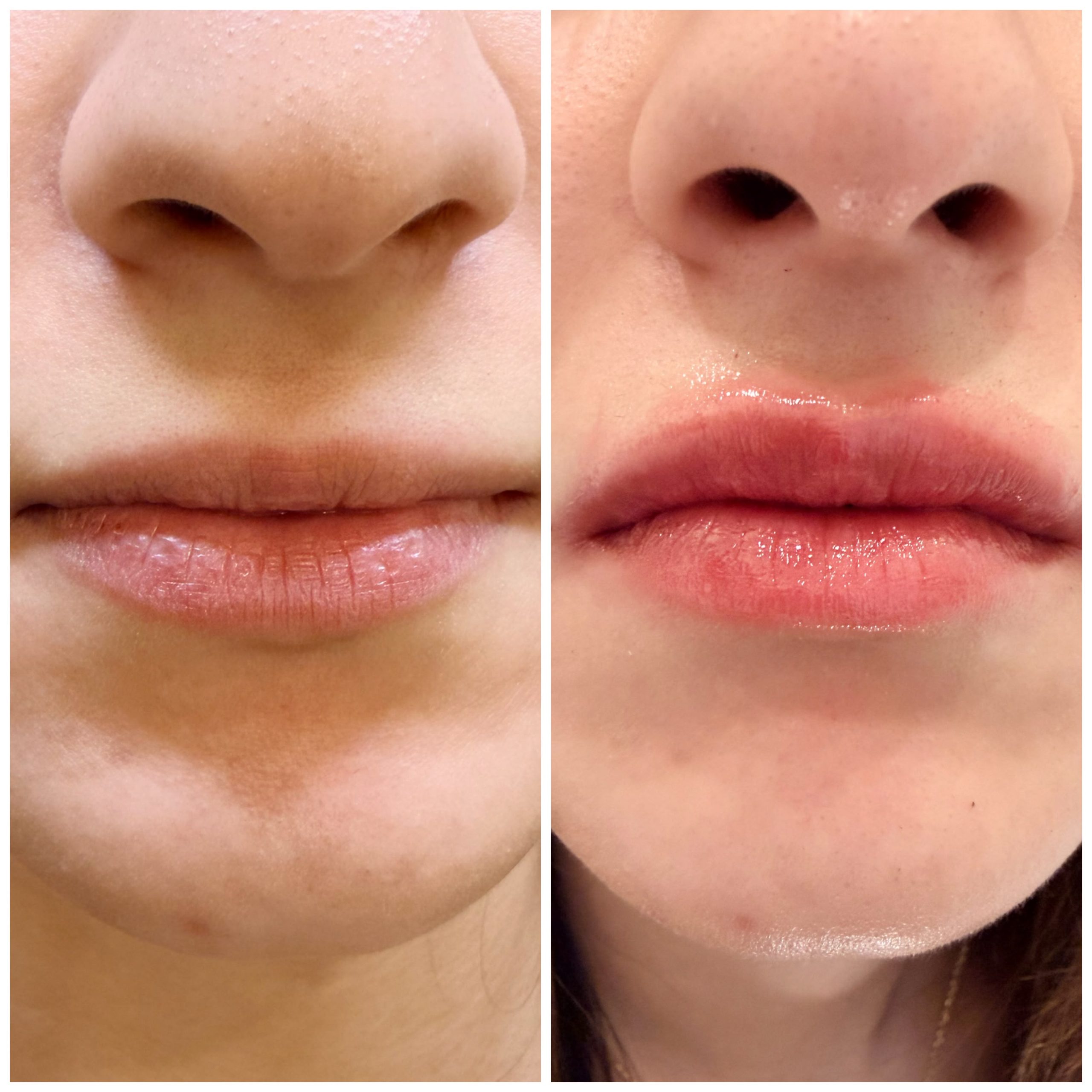 Mintus treatment before and after result 7